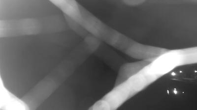 immagine della webcam nei dintorni di Roma Nord: webcam Bracciano